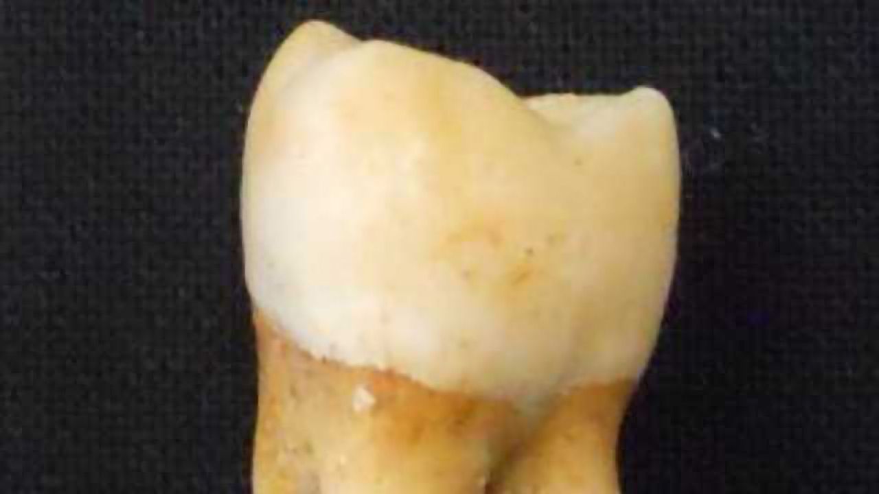 He or She? Remains Tell the Whole Tooth