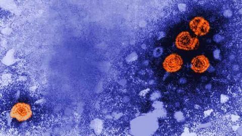 Illuminating Potentially Fatal Complication of Hepatitis B