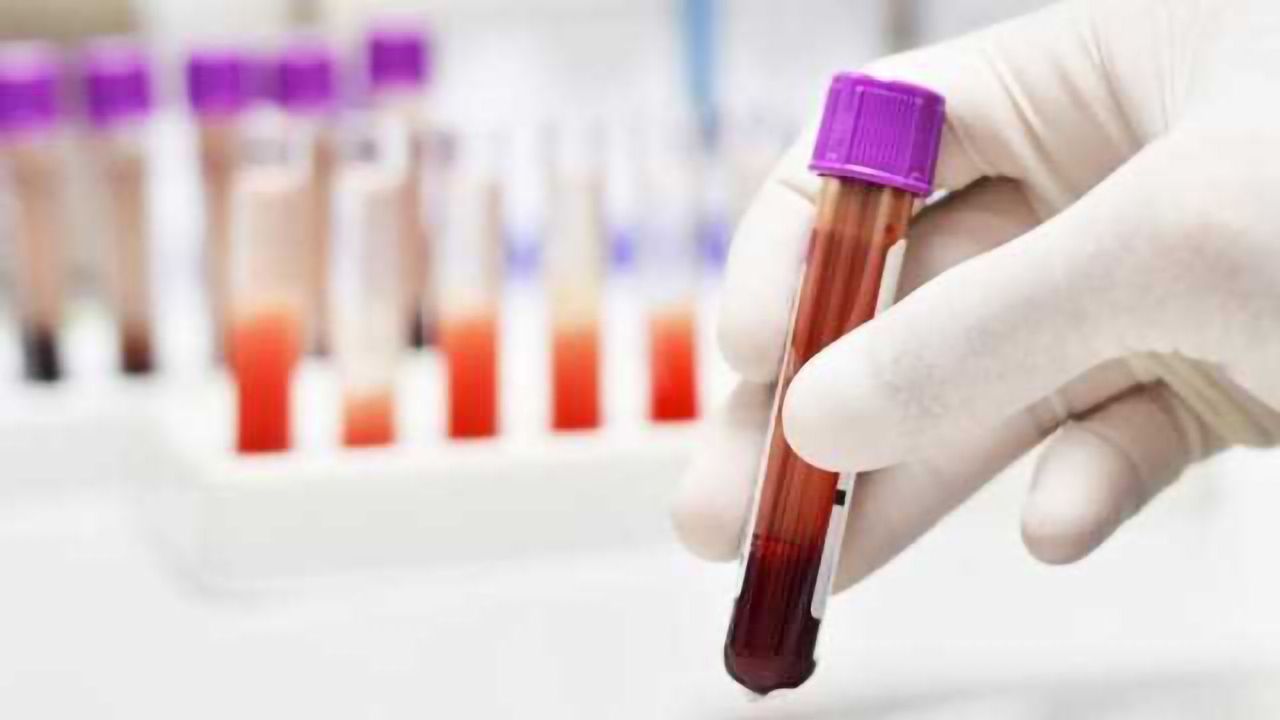 Blood Test Detects and Classifies Cancer at its Earliest Stages