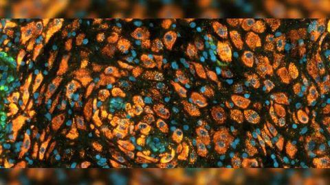 Human Cell Atlas Study Sheds Light on Maternal-Fetal Interface