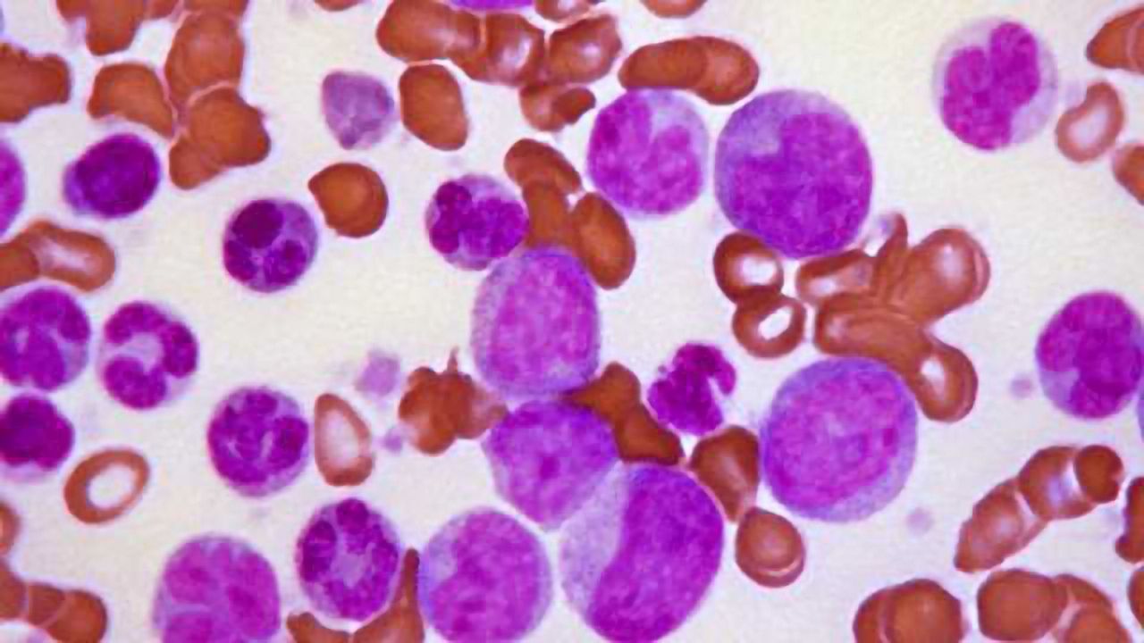 Leukemia Stem Cells Rely on Amino Acids for Survival