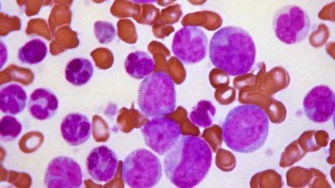 Leukemia Stem Cells Rely on Amino Acids for Survival