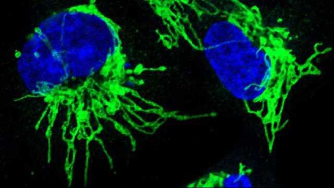 Pancreatic Cancer: Mechanism of treatment-resistance discovered