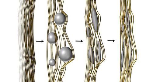 Skeletal Imitation Reveals Bone Mineralization in Fine Detail