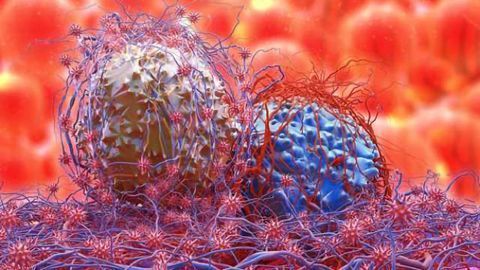 Drug Discovery Could Halt Brain Cancer Spread