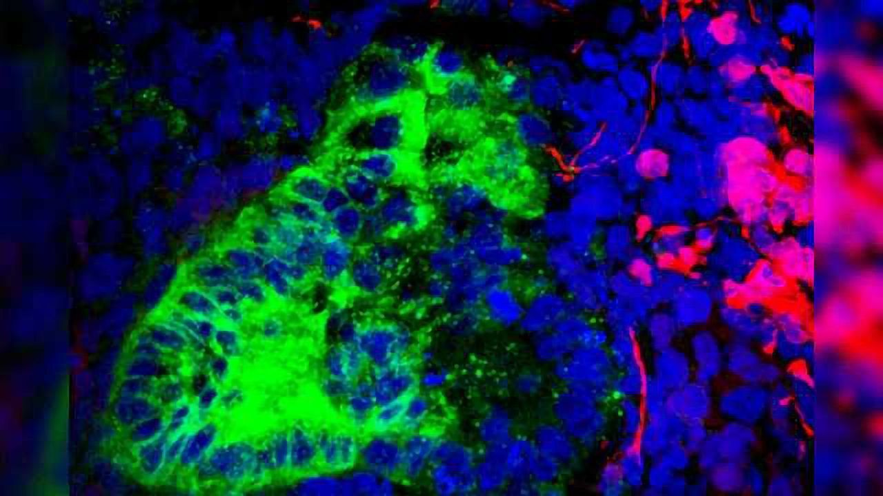 10-20% of Cells in a Kidney Organoid Found to be Non-Renal
