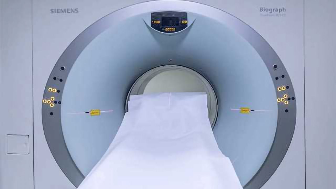 MRI Scans Shows Promise in Predicting Dementia