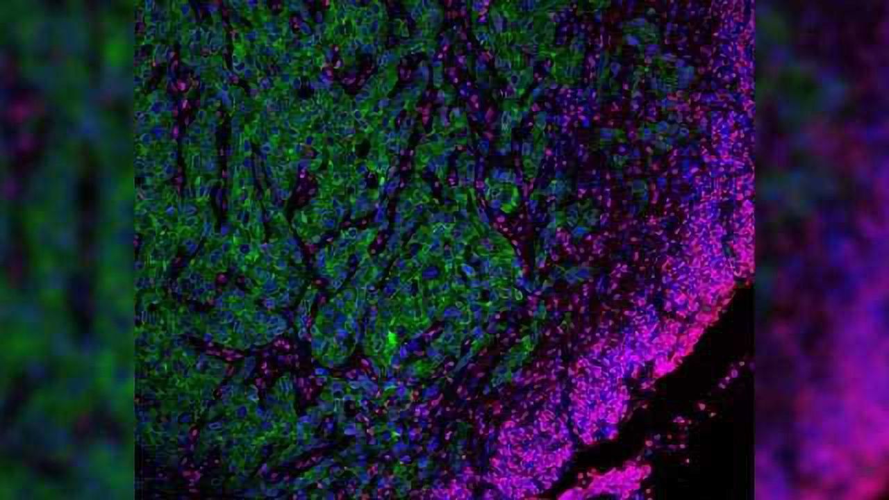 Epigenetic Treatments Could Trigger Aggressive Tumors