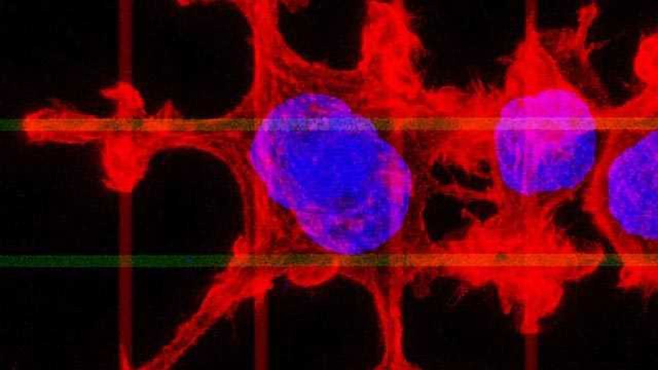 ‘Sneaky’ Cancer Cells Stopped in Their Tracks
