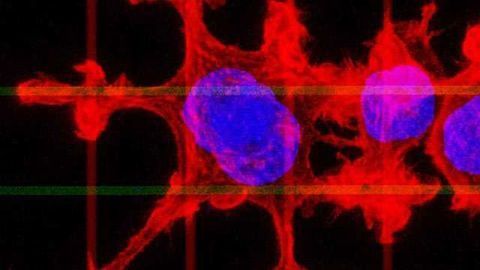 ‘Sneaky’ Cancer Cells Stopped in Their Tracks