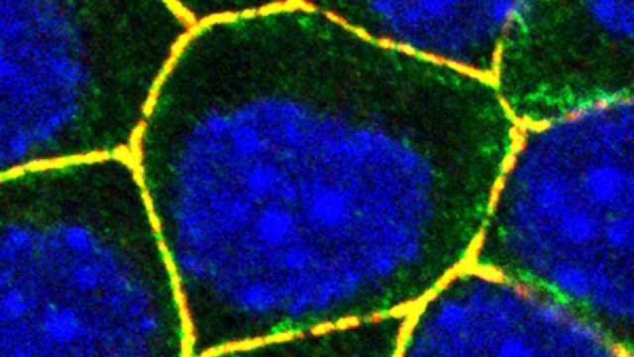 Staphylococcus aureus's Trojan Horse