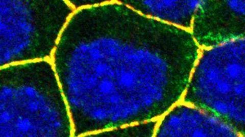 Staphylococcus aureus's Trojan Horse