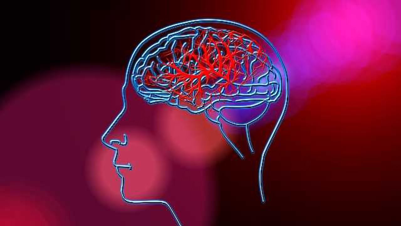 Using Big Data to Reduce the Risk of Stroke