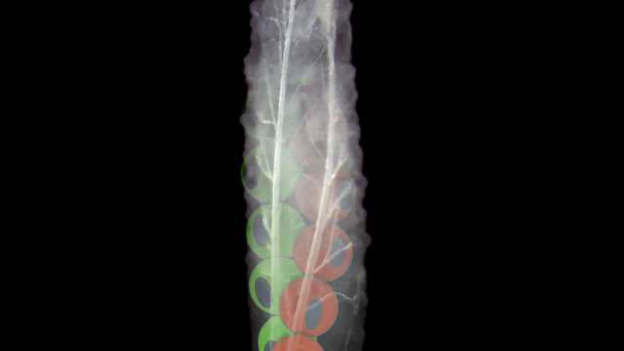 Protein that Makes Us Wonky