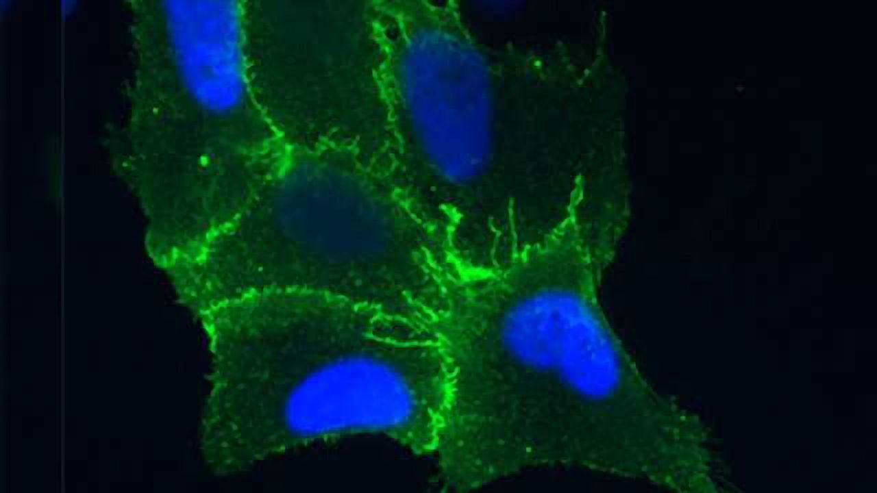 Hantavirus Mode of Entry a Possible Target to Reduce Transmission