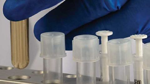 New Diagnostic Test Helps Hospitals More Quickly Identify and Treat Emerging Antibiotic-Resistant Bacteria