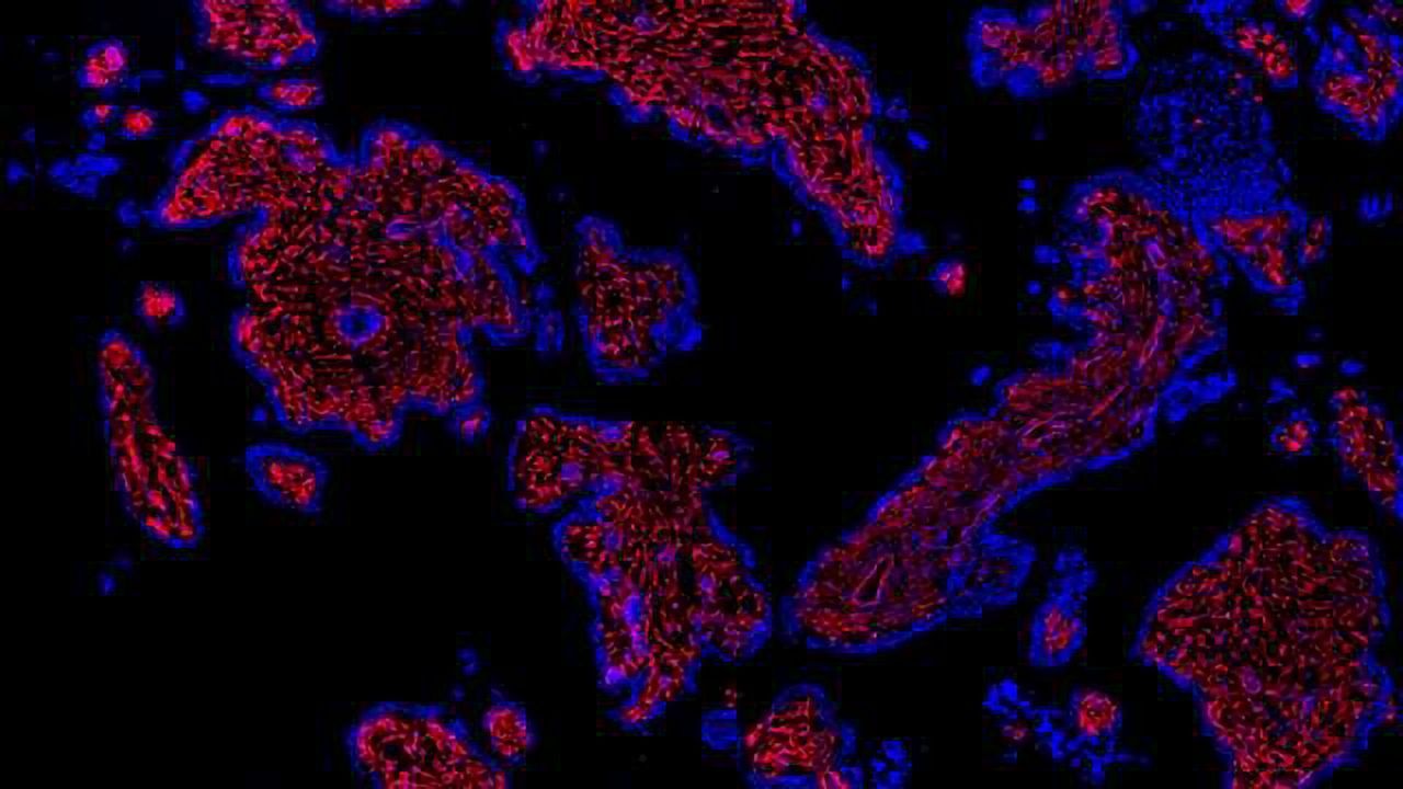 Single-cell Survey of Human Placenta in First-Trimester