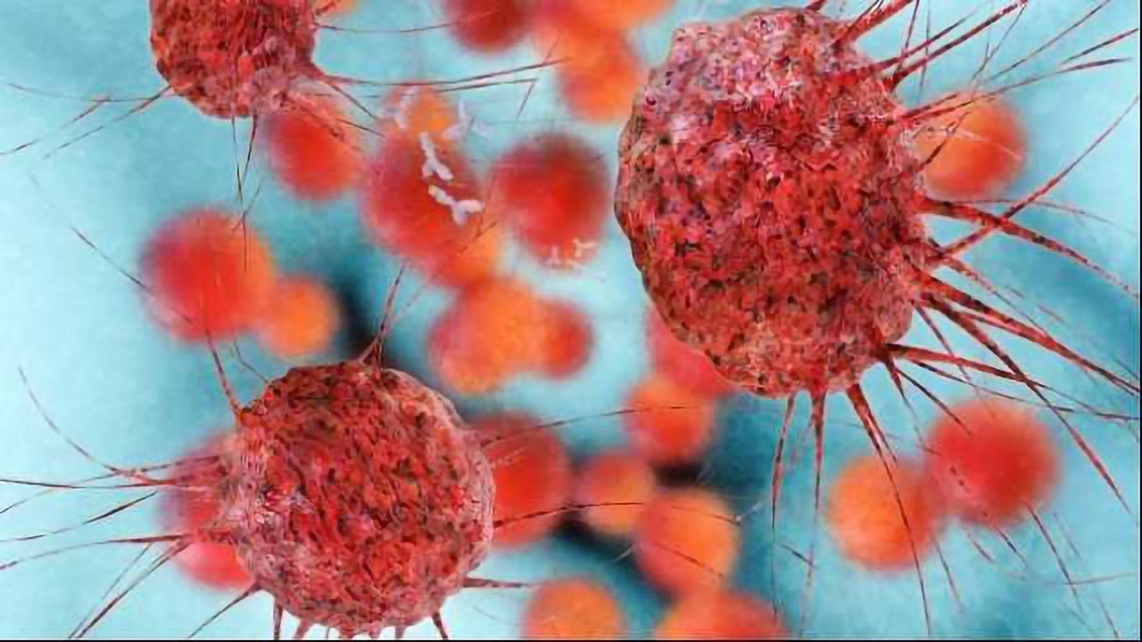 Targeting MC1R in Metastatic Melanoma
