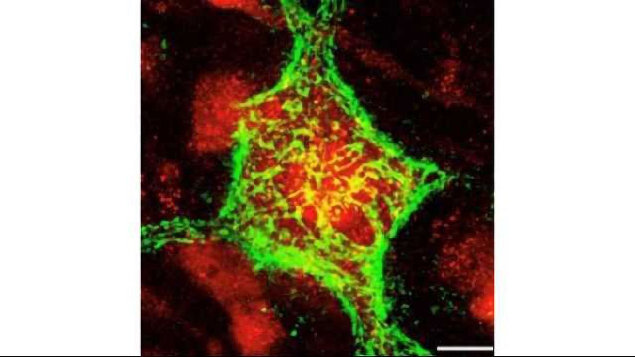 Chondroitinase Treatment Restores Movement in Paralyzed Rats