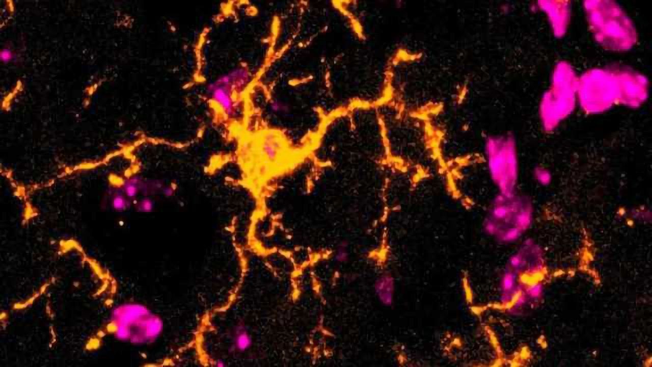 Microglia Have a Distinct Response to Acute Inflammation