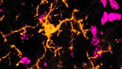 Microglia Have a Distinct Response to Acute Inflammation