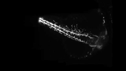 Light Sheet Imaging Helps Capture Zebrafish Neural Development