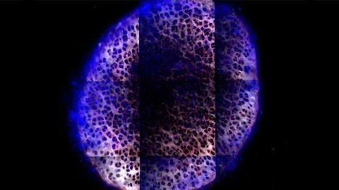 Potential Arthritis Drug Prevents Cartilage Breakdown