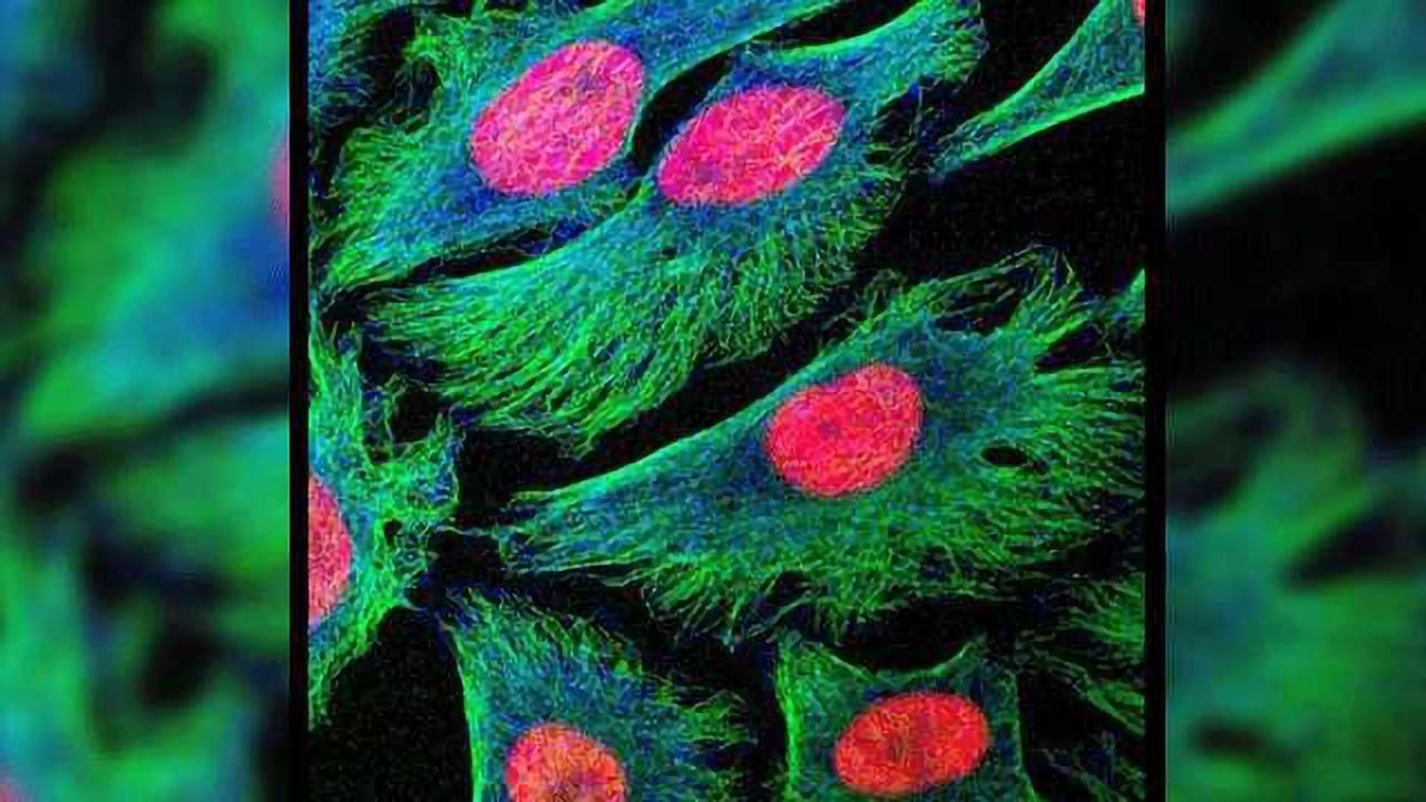 10 Tips for Quantifying Immunohistochemistry Staining