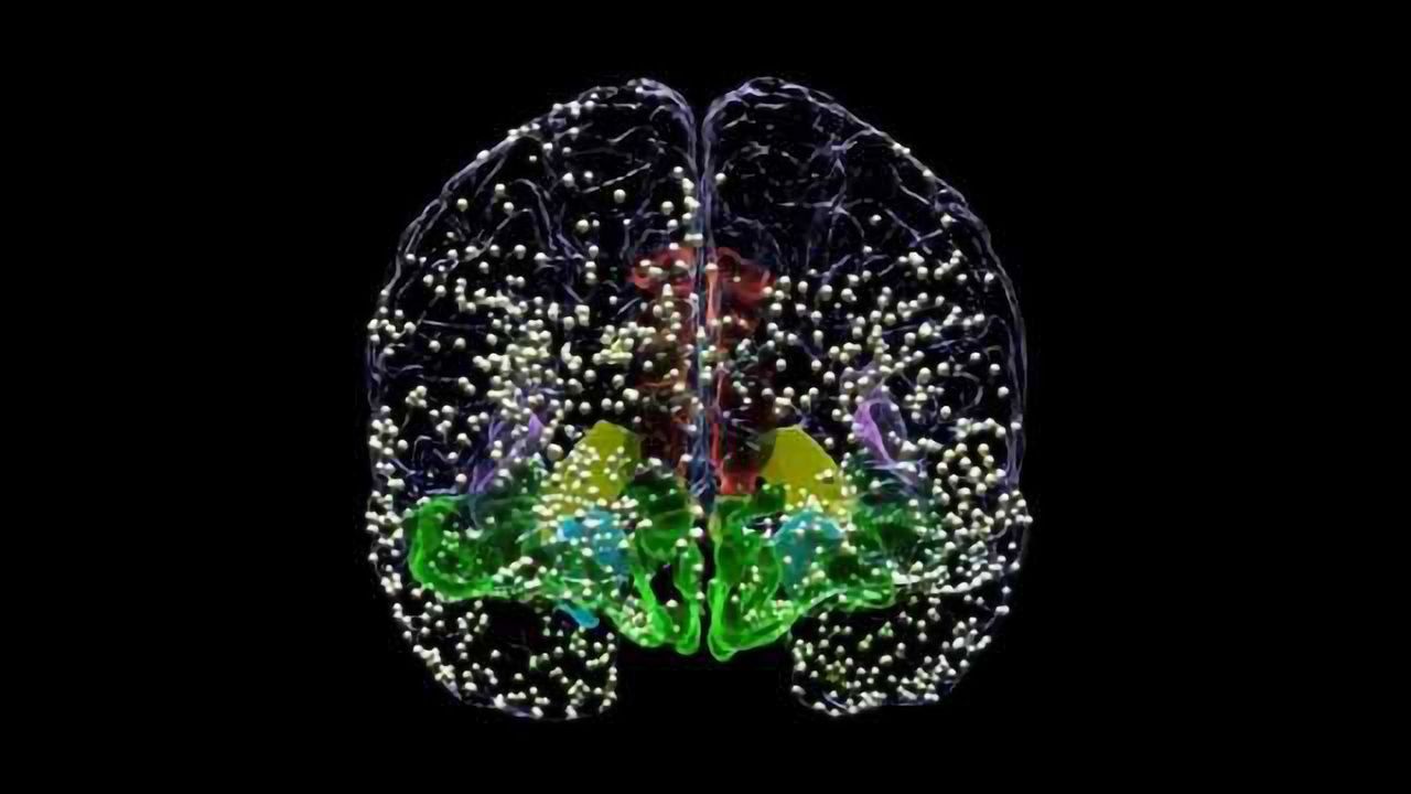 Brain Stimulation Relieves Depression Symptoms
