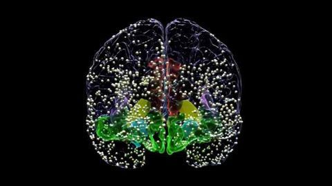 Brain Stimulation Relieves Depression Symptoms