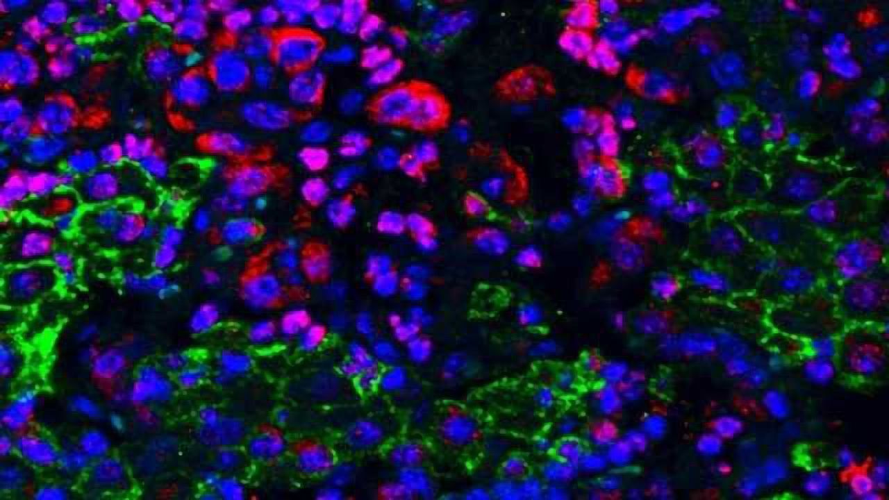Checkmating Tumors