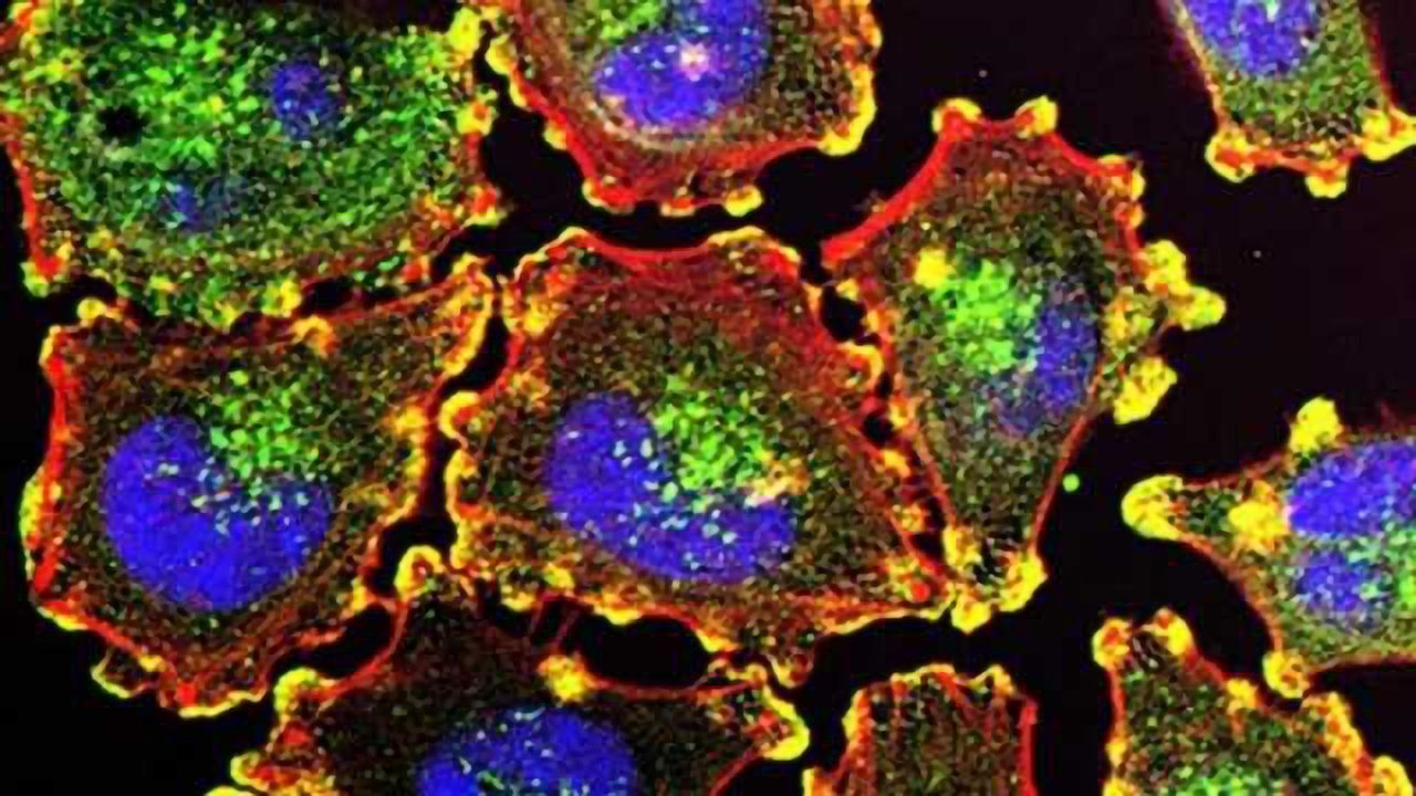 Drug Combo Could Be More Effective Against Melanoma