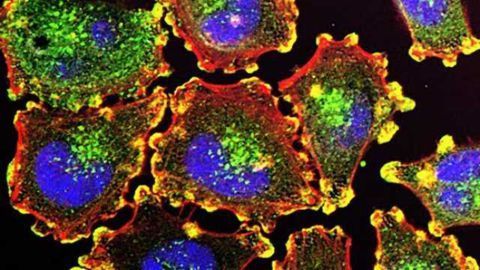Drug Combo Could Be More Effective Against Melanoma