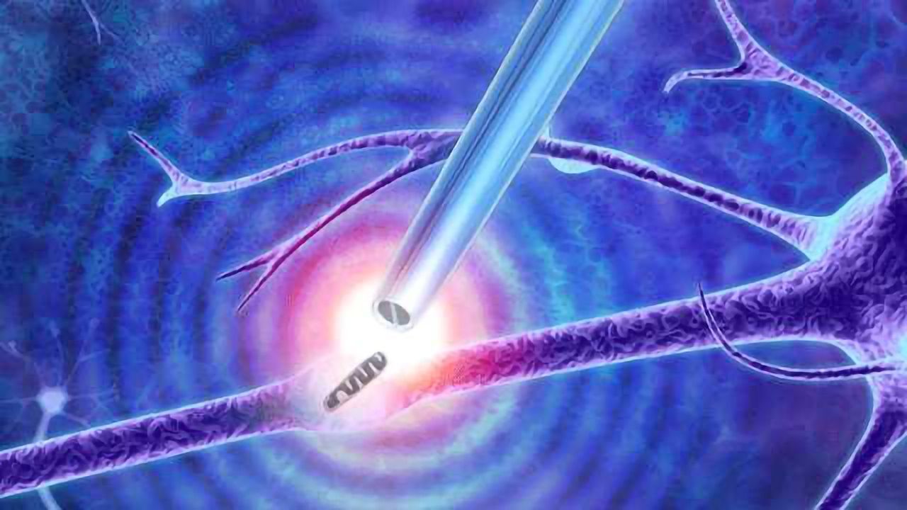 Nanoscale Tweezers Can Perform Single-molecule 'Biopsies'
