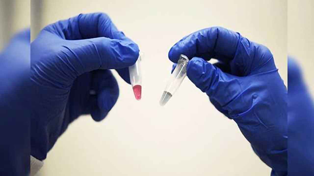 Universal Cancer Test: One Test to Diagnose Them All?
