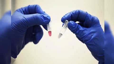 Universal Cancer Test: One Test to Diagnose Them All?