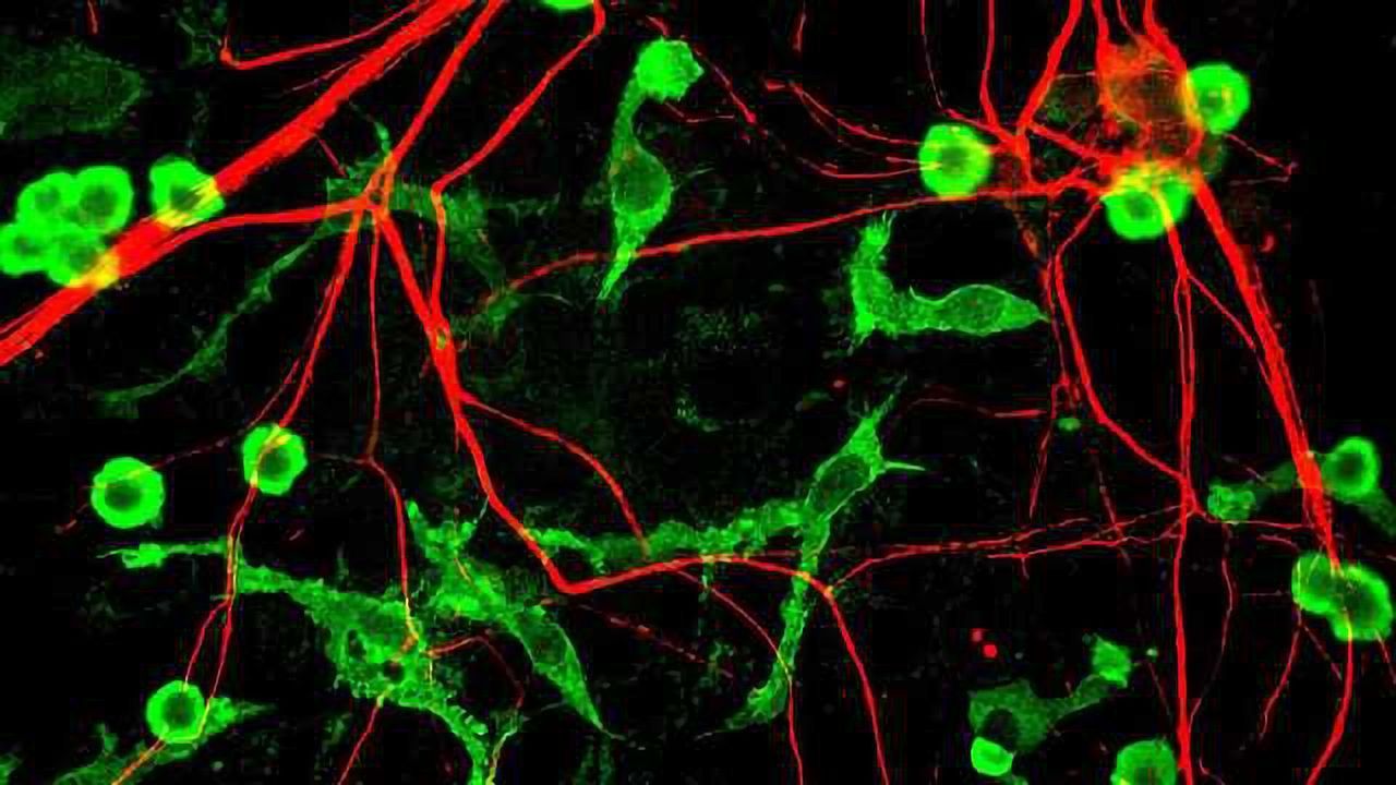 Microglial Memories of Stress