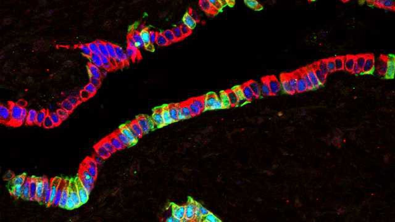 Emerging Evidence for the Pancreatic Progenitor Cell Hypothesis