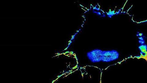Sensors Detect & Measure Cancer’s Ability to Spread