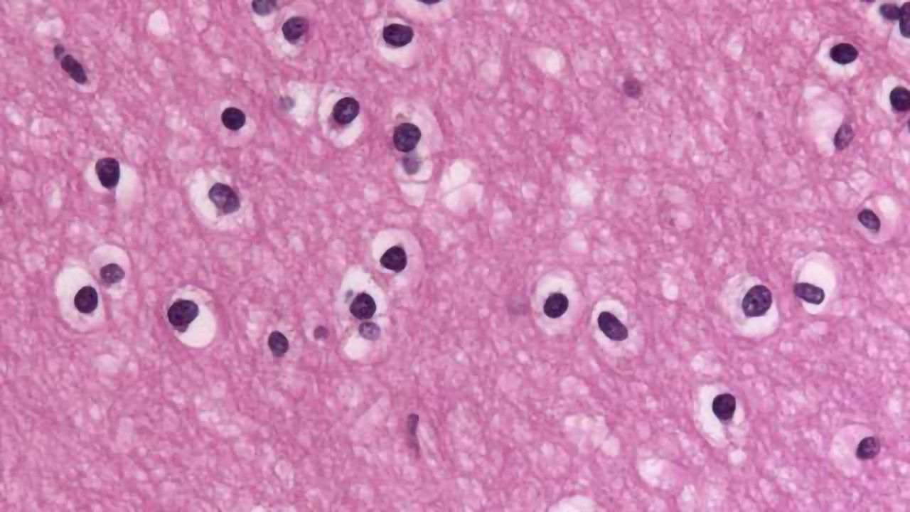 Oligodendrocytes, Microglia and Astrocytes Linked to 'Chemo Brain'