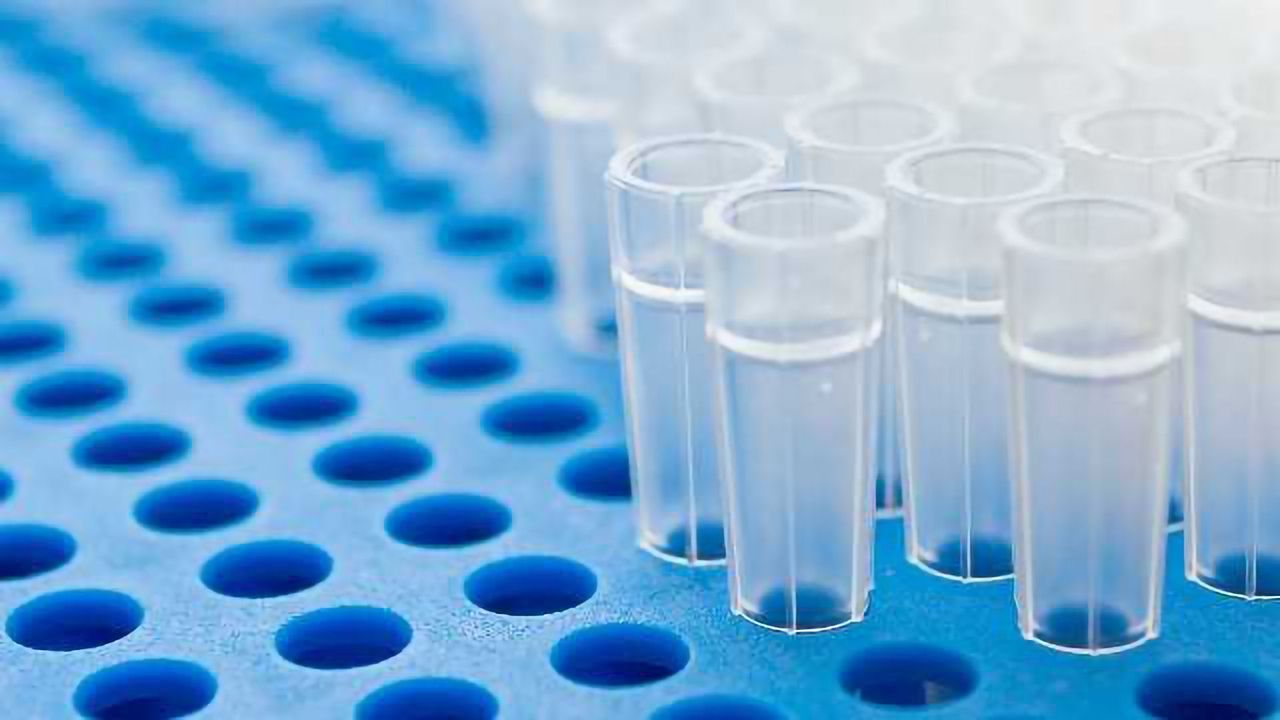 3 Top Tips for RNA Extraction From Mouse Brain Tissue