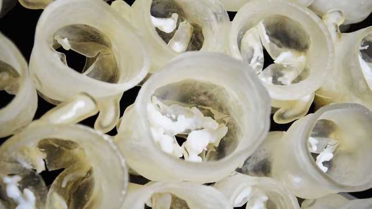 Predicting Leaky Heart Valves with 3D Printing