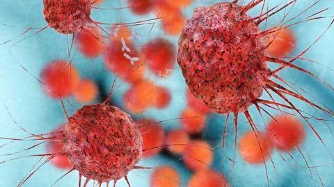 Sprayable Gel Could Help the Body Fight Off Cancer After Surgery