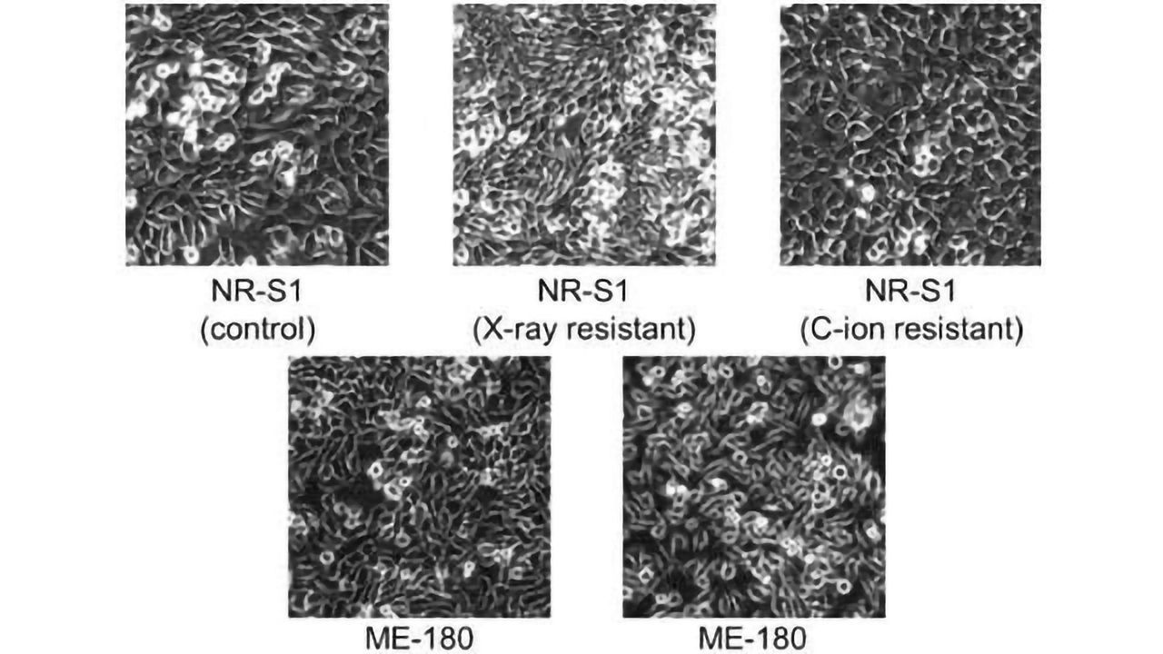 Identifying Different Types of Cancer Cells Using AI