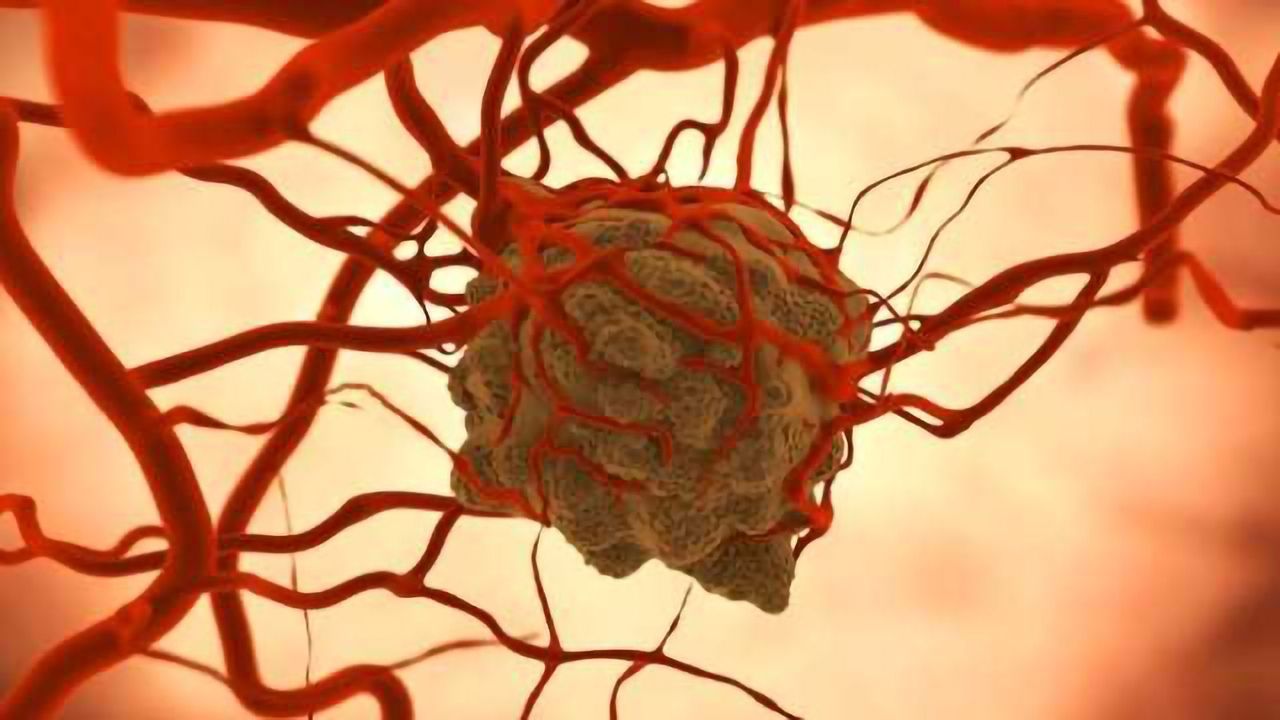 Deciphering Mechanisms of Childhood Tumor Growth & Regression