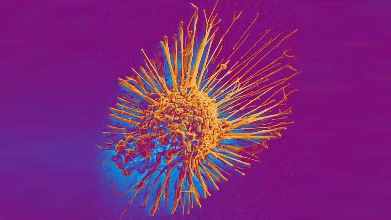 Drug Cocktail Cripples Cancer Cells