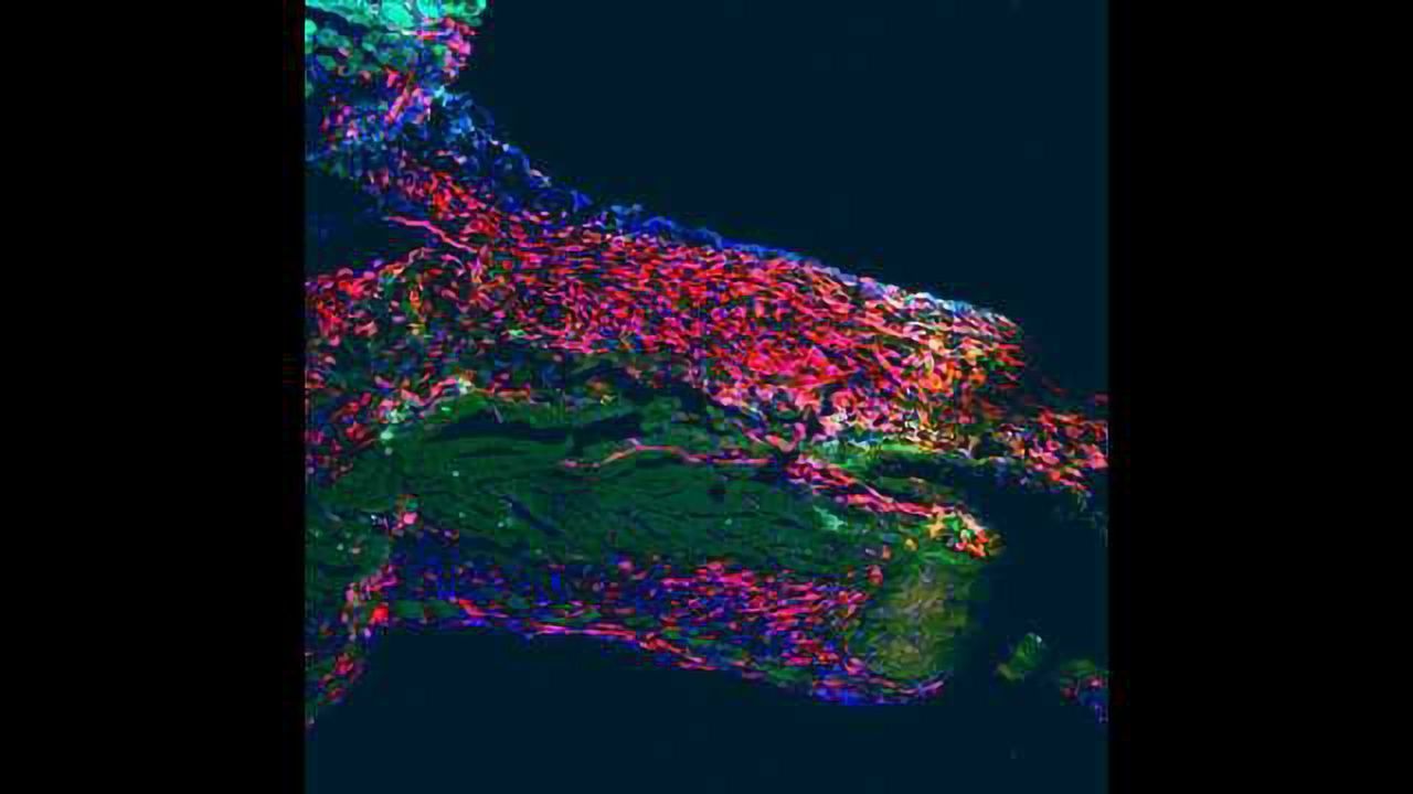 A Sobering Conclusion: Adult Hearts Do Not Contain Stem Cells