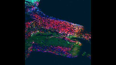 A Sobering Conclusion: Adult Hearts Do Not Contain Stem Cells