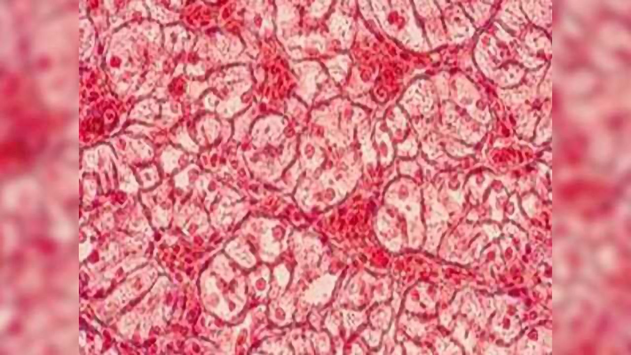 Loss of Tight Junction Protein Promotes Development of Precancerous Cells