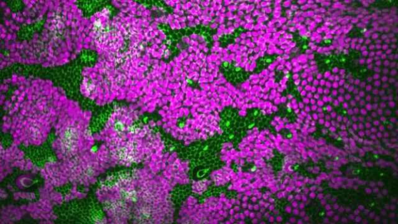 Tumor Cells Invade & Conquer – But How?